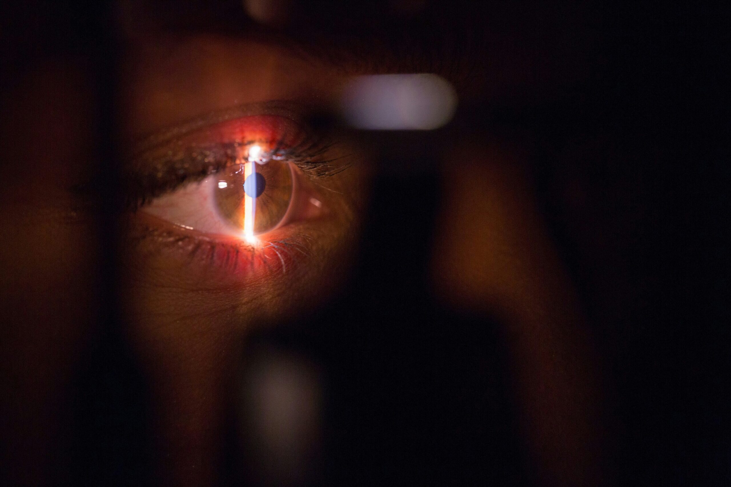 eye health